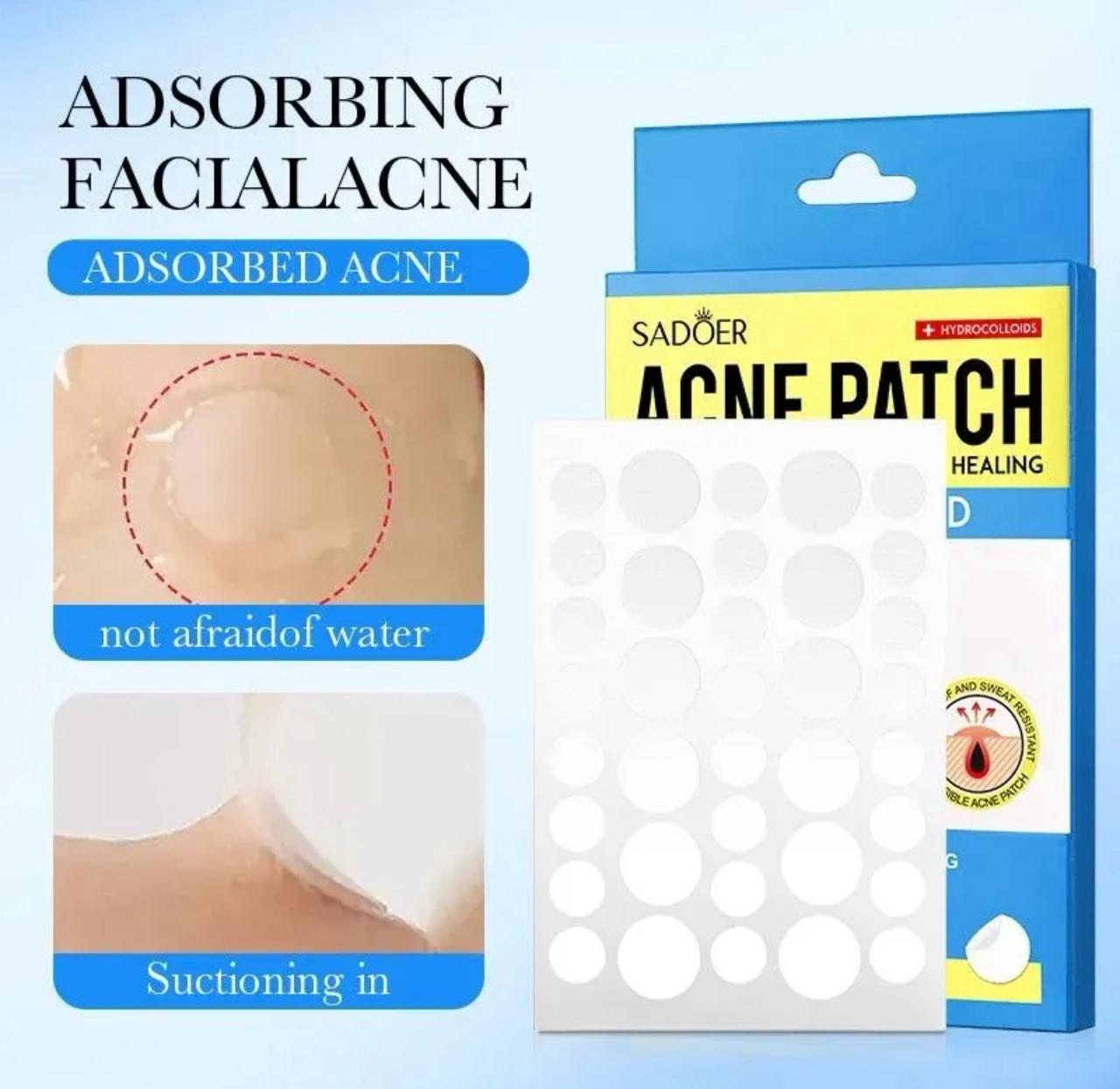 Pimple Patches for Acne Removal & Healing with Salicylic Acid – 36 Patches