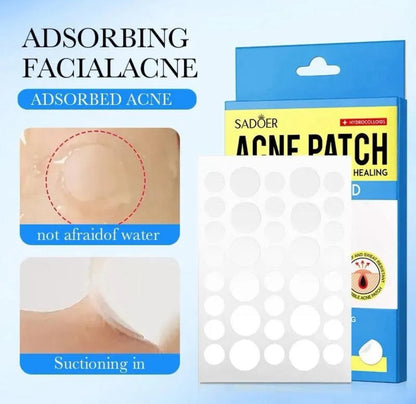 Pimple Patches for Acne Removal & Healing with Salicylic Acid – 36 Patches