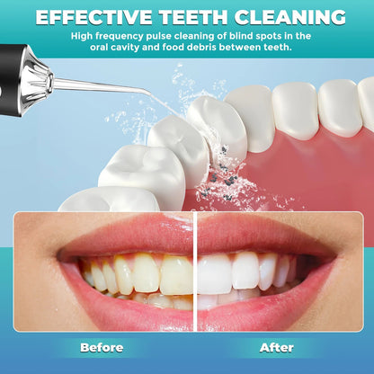 Travel Dental Water Flosser for Teeths